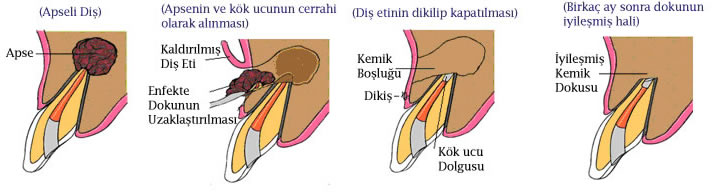 cerrahi2